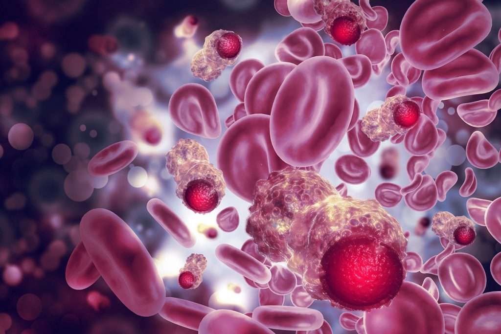 Mes mundial contra el cáncer:  abc para abordar la enfermedad y mejorar la calidad de vida